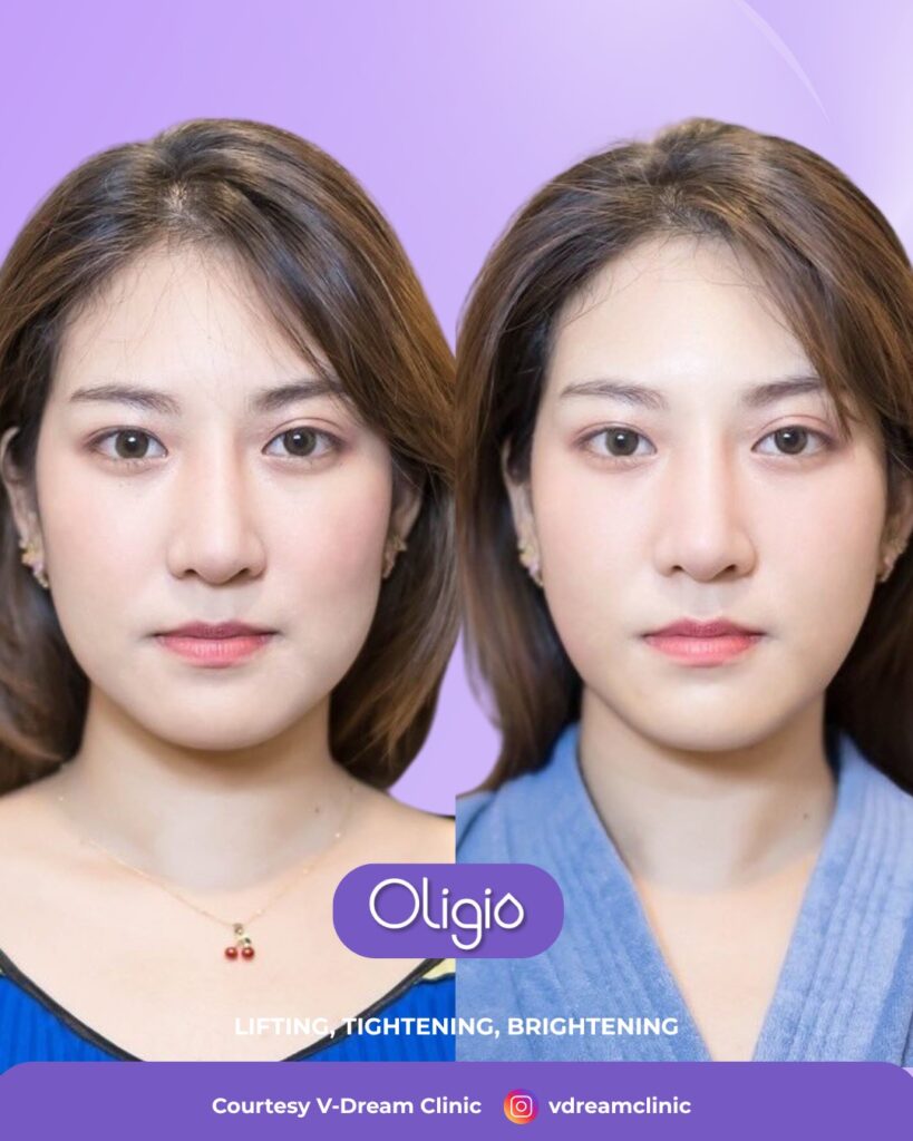 muka awet muda